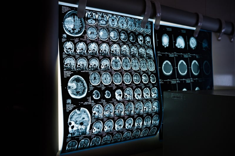 Temporal Scanner